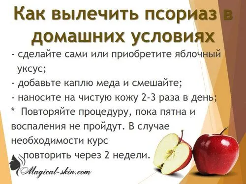 псоріаз рука фото початкова стадія лікоть палець лікування домашнє умова