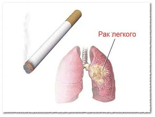 респіраторні захворювання