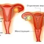 менструації