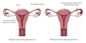 менструального циклу