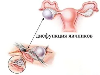 якого кольору виділення при місячних