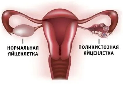 менструальним циклом