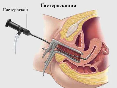 менструальний цикл