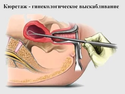 місячних