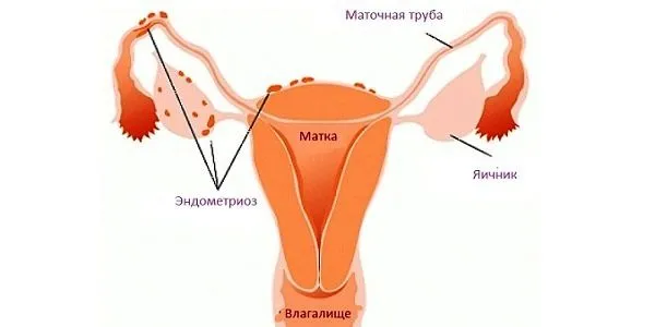 Коричневі виділення після місячних - через тиждень, чому йдуть, причини, темно коричневі, світло, з неприємним запахом, без запаху (менструальним циклом) місячних