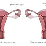 менструації