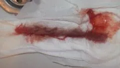 менструації
