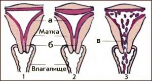 місячні