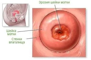 світло коричневі виділення перед місячними