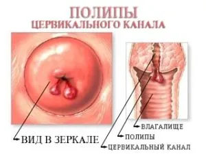 менструальним циклом