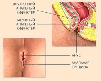 менструації