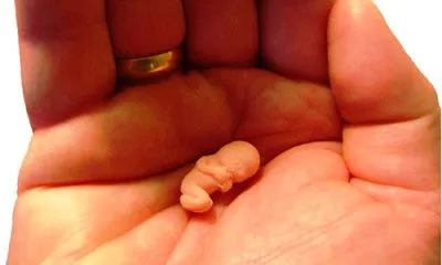 Скільки може бути затримка місячних без вагітності: максимальна норма днів (скільки може бути затримка місячних) місячні