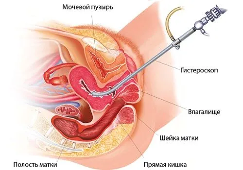 місячні