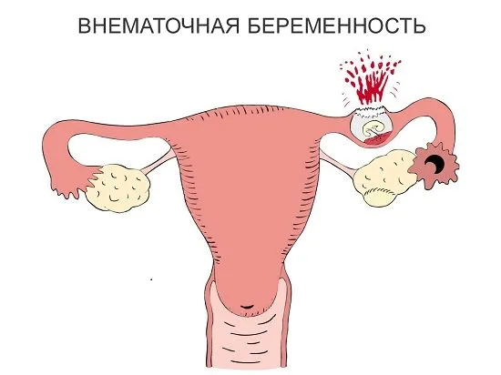 внизу живота