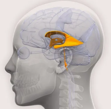 Asimetria ventriculii creierului simptome caracteristice
