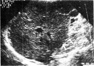 examinarea cu ultrasunete