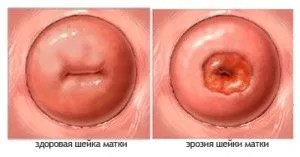 місячні
