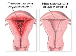 організм жінки