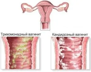 місячних