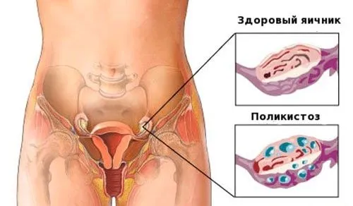 Дізнайтеся через скільки днів після місячних настає овуляція (місячні) організм жінки