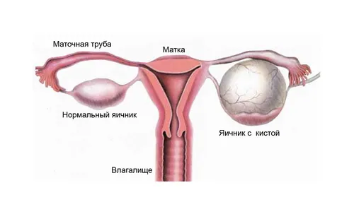 болить