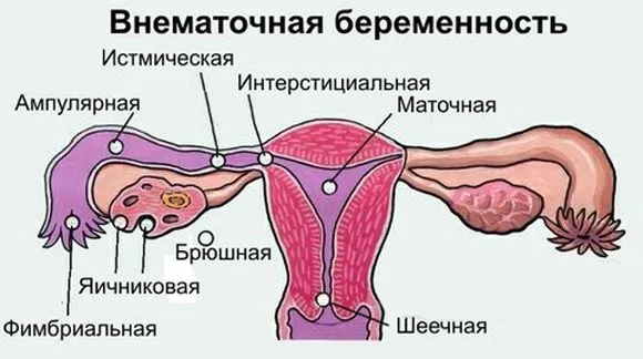 місячні
