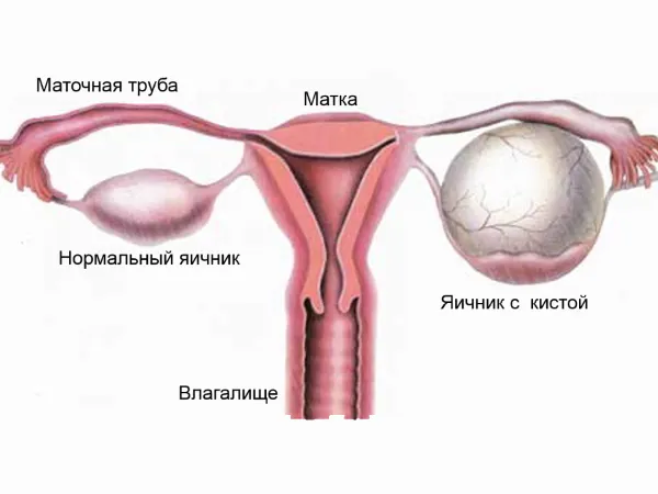 місячні