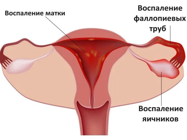 місячні