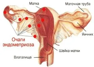 Виділення перед місячними (менструального циклу) менструальним циклом