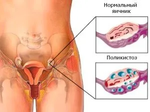 місячні