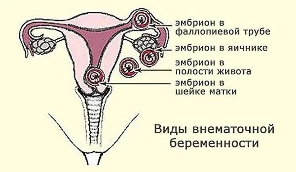 місячних може