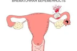 місячні