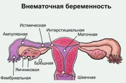 місячні