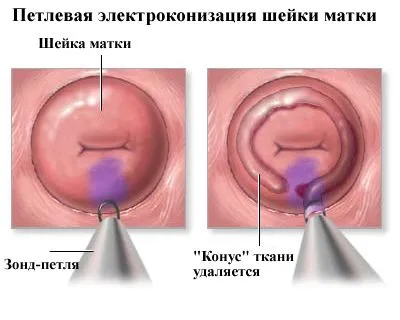 викликати місячні