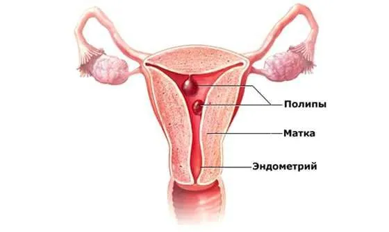 Чому бувають мізерні місячні (менструація) місячні