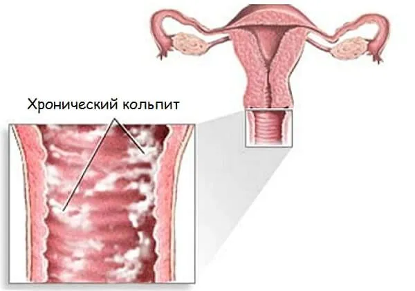 тест негативний