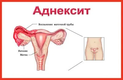 менструації