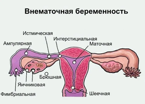 місячні