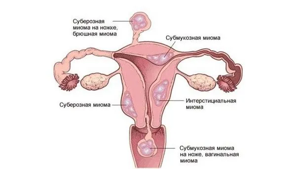 Часті місячні після 40 років: причини (менструального циклу) місячних