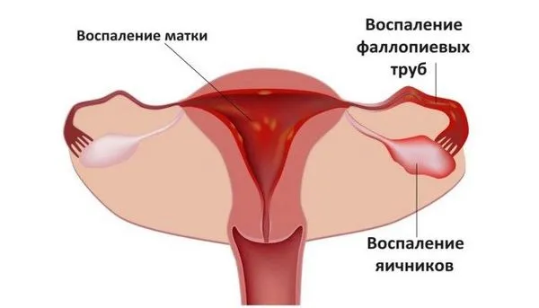 Часті місячні після 40 років: причини (місячних) менструального циклу