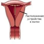 місячні