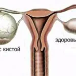 як зрозуміти визначити що настала відбувається овуляція