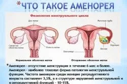 Як відновити місячні (місячні) місячні