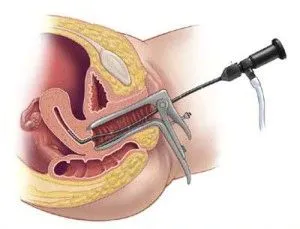 місячних