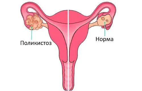 місячних