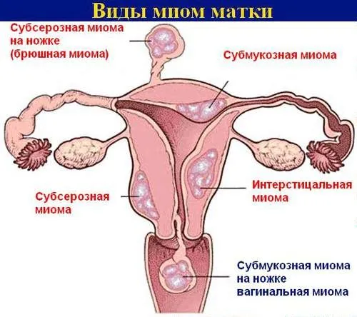 живота