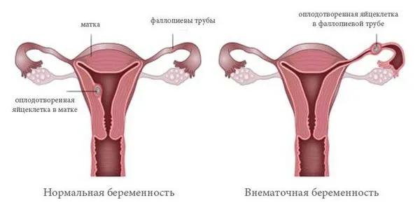 місячних