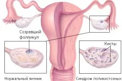 менструальним циклом