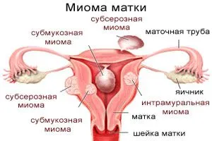 менструації