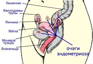місячних